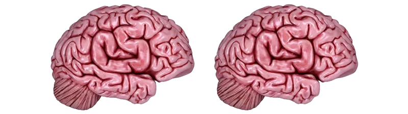 Sticker | CS On The Mind