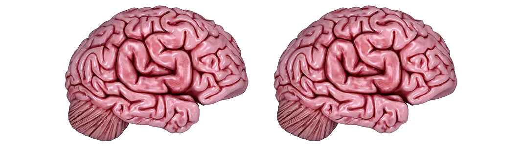Sticker | CS On The Mind